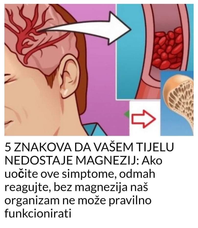 Znakova Da Va Em Tijelu Nedostaje Magnezij Ako Uo Ite Ove Simptome