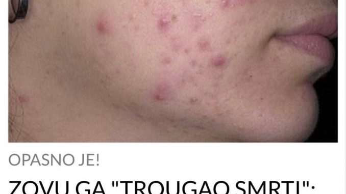 '