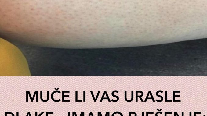 '