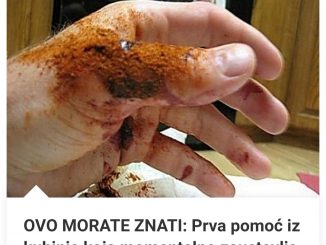 OVO MORATE ZNATI: Prva Pomoć Iz Kuhinje Koja Momentalno Zaustavlja Krv