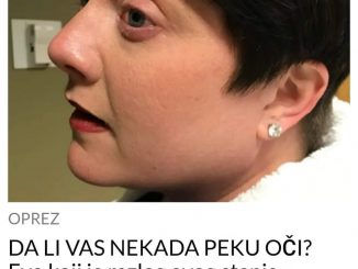 DA LI VAS NEKADA PEKU OČI? Evo koji je razlog ovog stanja, odmah PROVJERITE