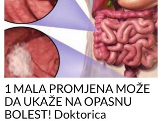 1 MALA PROMJENA MOŽE DA UKAŽE NA OPASNU BOLEST! Doktorica upozorila: Niko na to ne obraća pažnju!