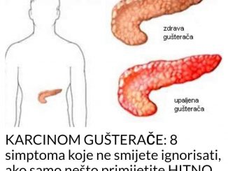 KARCINOM GUŠTERAČE: 8 simptoma koje ne smijete ignorisati, ako samo nešto primijetite HITNO IDITE DOKTORU!