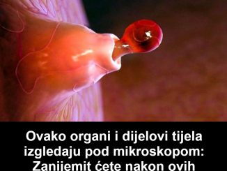 Ovako organi i dijelovi tijela izgledaju pod mikroskopom: Zanijemit ćete nakon ovih fotografija