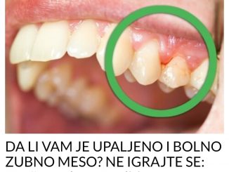 DA LI VAM JE UPALJENO I BOLNO ZUBNO MESO? NE IGRAJTE SE: Evo šta trebate uraditi