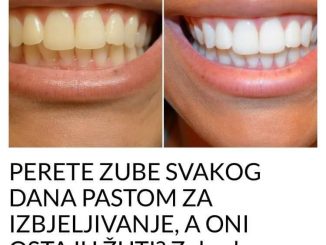 PERETE ZUBE SVAKOG DANA PASTOM ZA IZBJELJIVANJE, A ONI OSTAJU ŽUTI? Zubarka otkrila ŠTA STVARNO DJELUJE