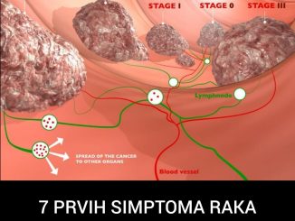 7 PRVIH SIMPTOMA RAKA DEBELOG CRIJEVA: 90% ljudi IGNORIŠE ALARM koji tijelo šalje!