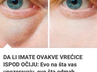 DA LI IMATE OVAKVE VREĆICE ISPOD OČIJU: Evo na šta vas upozoravaju, evo šta odmah MORATE PRESTATI JESTI!