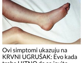 Ovi simptomi ukazuju na KRVNI UGRUŠAK: Evo kada treba HITNO da se javite ljekaru!