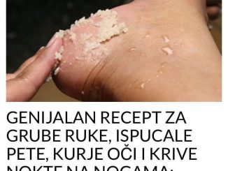 GENIJALAN RECEPT ZA GRUBE RUKE, ISPUCALE PETE, KURJE OČI I KRIVE NOKTE NA NOGAMA: Obavezno zapišite, nećete se pokajati