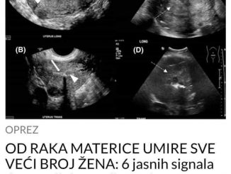 OD RAKA MATERICE UMIRE SVE VEĆI BROJ ŽENA: 6 jasnih signala da se u tijelu razvija ovaj opasan tumor!