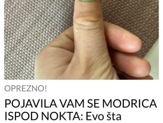 POJAVILA VAM SE MODRICA ISPOD NOKTA:  Evo šta trebate odmah uraditi, NE ČEKAJTE NI SEKUNDU