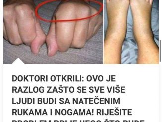 Doktori 0TKRILI:  0vo Je Razlog Zašto Se Sve Više Ljudi Budi Sa NATEČENIM Rukama I Nogama! Riješite Problem Prije Nego Što Bude Prekasno!