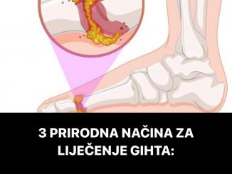 3 PRIRODNA NAČINA ZA LIJEČENJE GIHTA:  Izbacite mokraćnu kiselinu iz tijela!