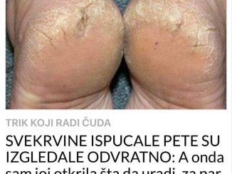 SVEKRVINE ISPUCALE PETE SU IZGLEDALE ODVRATNO:  A onda sam joj otkrila šta da uradi, za par dana su postale GLATKE KAO U BEBE