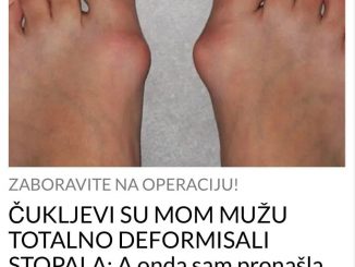 ČUKLJEVI SU MOM MUŽU TOTALNO DEFORMISALI STOPALA:  A onda sam pronašla ovaj recept, KAO DA IH NIKAD NIJE BILO