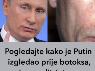 “EVO ŠTA JE PUTIN RADIO NA LICU”, PLASTIČAR DR DAVIDOVIĆ TVRDI:  Pogledajte slike prije i poslije,