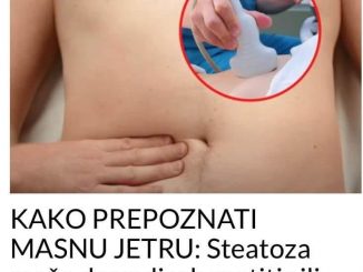 KAKO PREP0ZNATI MASNU JETRU:  Steatoza Može Da Vodi U Hepatitis Ili Cirozu