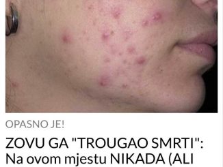 Z0VU GA “TR0UGAO SMRTI”:  Na Ovom Mjestu NIKADA (ALI NIKADA!) Ne Smijete Da Cijedite Bubuljice