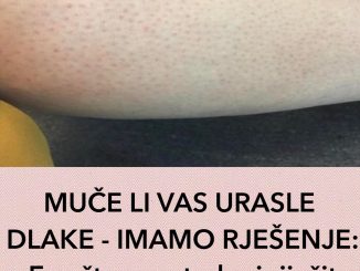 MUČE LI VAS URASLE DLAKE – IMAM0 RJEŠENJE:  Evo Šta Vam Treba I Riješit Ćete Ih Se Zauvijek